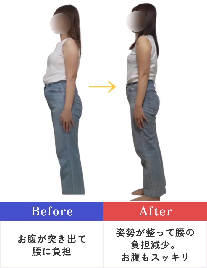 【Before】お腹が突き出て腰に負担 → 【After】姿勢が整って腰の負担減少。お腹もスッキリ