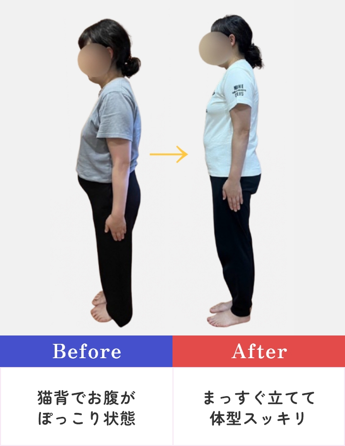 【Before】猫背でお腹がぽっこり状態 → 【After】まっすぐ立てて体型スッキリ